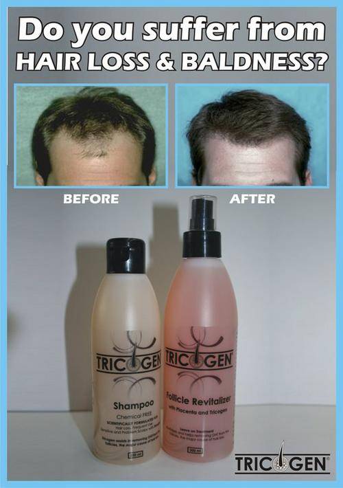 Hair Loss Prevention & Care Tricogen Hair Loss Treatment was sold for R659.99 on 10 Mar at 11
