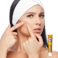 Hair Follicle Cream Treat Folliculitis Skin Inflammation Antibacterial Ointment