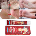 Anti Crack Foot Cream Oil Anti-Drying Crack Feet Cream Heel Cracked Repair Cream Removal Bad Skin...