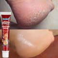 Anti Crack Foot Cream Oil Anti-Drying Crack Feet Cream Heel Cracked Repair Cream Removal Bad Skin...