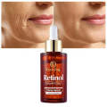 Retinol Nicotinamide Anti Wrinkle Concentrate Face Serum 40ml