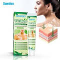 Sumifun Vitiligo Treatment Ointment - Vitiligo Remover & Vitiligo Cream. (20G)