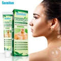 Sumifun Vitiligo Treatment Ointment - Vitiligo Remover & Vitiligo Cream. (20G)