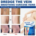 Varicose Vein Patches (8pc)for Varicose Veins Treatment Vasculitis Phlebitis Angiitis Cure