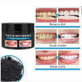Advanced Teeth Whitening - 60g