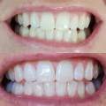 NU SKIN AP24 Teeth Whitening Paste