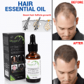 Hair Essential Oil Anti Hair Loss Oil 30g