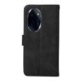 For Honor 100 Pro Classic Calf Texture Flip Leather Phone Case(Black)