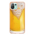 For Xiaomi 11 Lite Electroplating Marble Dual-side IMD Phone Case(Draft Beer)