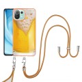 For Xiaomi Mi 11 Lite Electroplating Dual-side IMD Phone Case with Lanyard(Draft Beer)