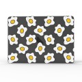 For MacBook Air 11.6 A1370 / A1465 UV Printed Pattern Laptop Frosted Protective Case(DDC-802)