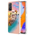 For Xiaomi Redmi Note 11 Pro 5G / 4G Global Electroplating IMD TPU Phone Case with Ring(Dream Butter