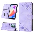 For Honor X6a Skin-feel Embossed Leather Phone Case(Light Purple)