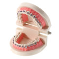 Dental Teeth Malocclusion Orthodontic Model With Full Metal Brackets Hoops Dentist Teaching