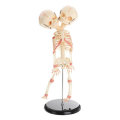 Double Head Baby Anatomy Skull Skeleton Anatomical Brain Anatomy Education Medical Model