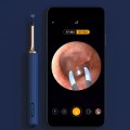(Color. White)Bebird Note 3 2 in 1 Smart Visible Ear Pick Tweezers Dual-use 1000W HD Endoscope E...