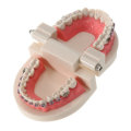 Dental Teeth Malocclusion Orthodontic Model With Full Metal Brackets Hoops Dentist Teaching