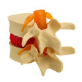Medical Lumbar Vertebrae Model Props Anatomical Spine Herniation Teaching Tool