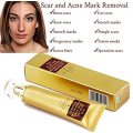 SkinRosa Scar Removal Cream and Acne Treatment Cream - Effectively Remove Acne and Scars like Burns,