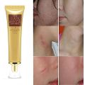 SkinRosa Scar Removal Cream and Acne Treatment Cream - Effectively Remove Acne and Scars like Burns,