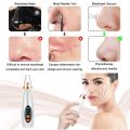 USB Rechargeable Multifunctional Blackhead Remover Vacuum Pores Cleaner