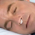 Snore Free Nose Clip