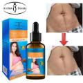 Snail Extract Stretch Mark Remover Essential