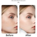 1831385 Ice Compress for Face
