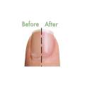 5 Minute Mani Healing Nail and Cuticle Mask Manicure Finger Set