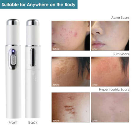 treatment scar massager