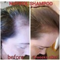 Nutriol Hair Growth Shampoo