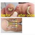 Ingrown Toe Nail Recover Toenail Correction  Fixer Straightener Pain relief