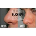 Pilaten 60g blackhead extraction removal black face mask.Wholesale From factory to you. Retail R220