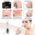 USB Rechargeable Vacuum Blackhead Remover and Pores Cleansing Device