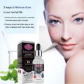 Aichun Beauty 2% Salicylic Acid Serum for Acne Prone Skin