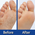Feet Exfoliating Foot Peel Cream