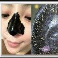 5 x 7 packets Amazing blackhead & acne removal masks