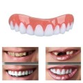 Cosmetic overlay on the upper teeth - Perfect Smile Veneers