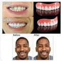 Cosmetic overlay on the upper teeth - Perfect Smile Veneers