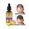 Disaar Ginger Hair Essential Oil - Anti Hair Loss Oil 40g