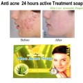 24 hours Aloe Acne Soap 100g. Coconut, olive, palm oils Hyaluronic acid Vitamin E Herbal extracts