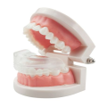 Orthodontic Appliance Silicone Simulation Braces Anti-Molar Braces (Third Stage)