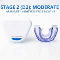 Orthodontic Dental Braces Anti-molar for Night (second stage) Orthodontic Teeth Alignment Appliance