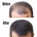 Thick Fiber Hair Building Fibers for Thinning and Fine hair - Grey