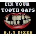 Teeth Repair Filling Temporary FILLERS - Large Pack