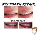 Tooth Repair - GAP DiY Temporary FILLERS - Large Pack
