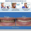 AMAZING SMILE Whitening and Polishing Teeth Cleaning and Stain Removal Machine