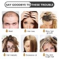 GINGER GERMINAL Anti-hair Loss and Hair Re-Growth Shampoo