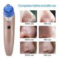 Easy To Use Vacuum Negative Pressure Acne Pore Cleansing Tool Blackhead Massager