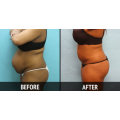 Full 5 week Wrap Fat Loss Program, DIY in the comfort of your home, No More Fat!